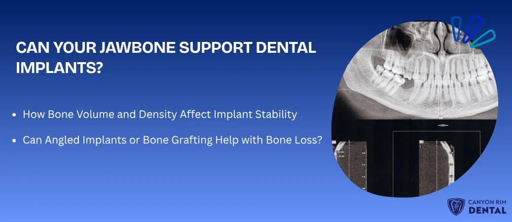 Do You Have Enough Jawbone to Support Implants