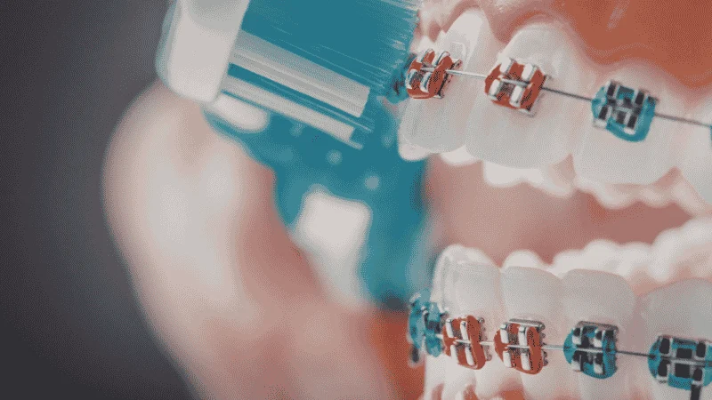 Maintaining Oral Health and Gum Support