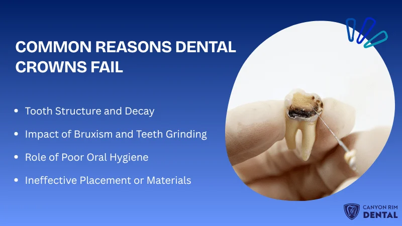 Why Dental Crowns Fail