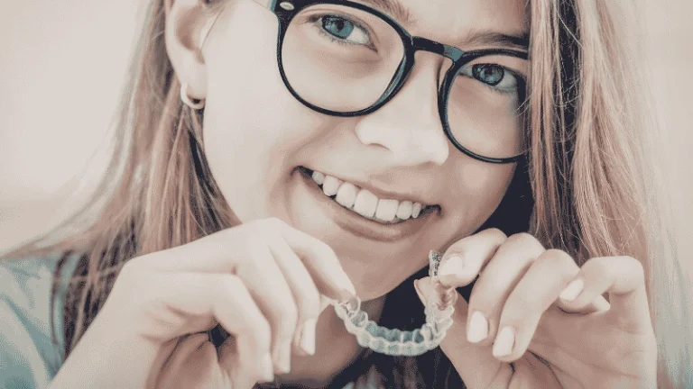 clear aligners for severe bite