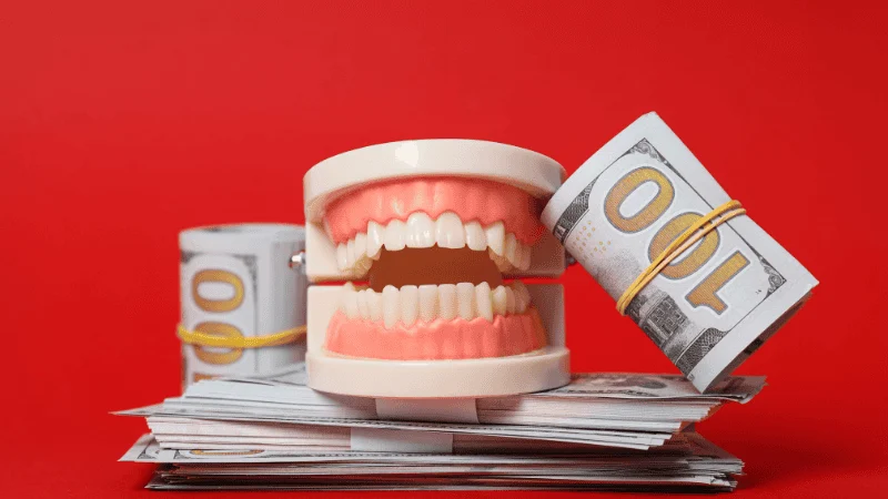 dental implant cost factors