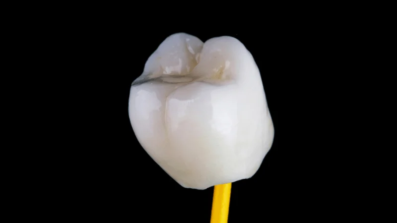 failed dental crown symptoms