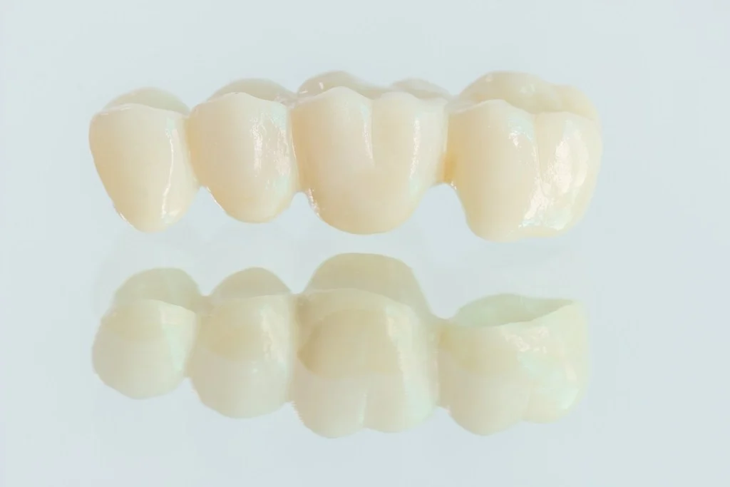 how a dental bridge benefits your smile 68a89ba396571