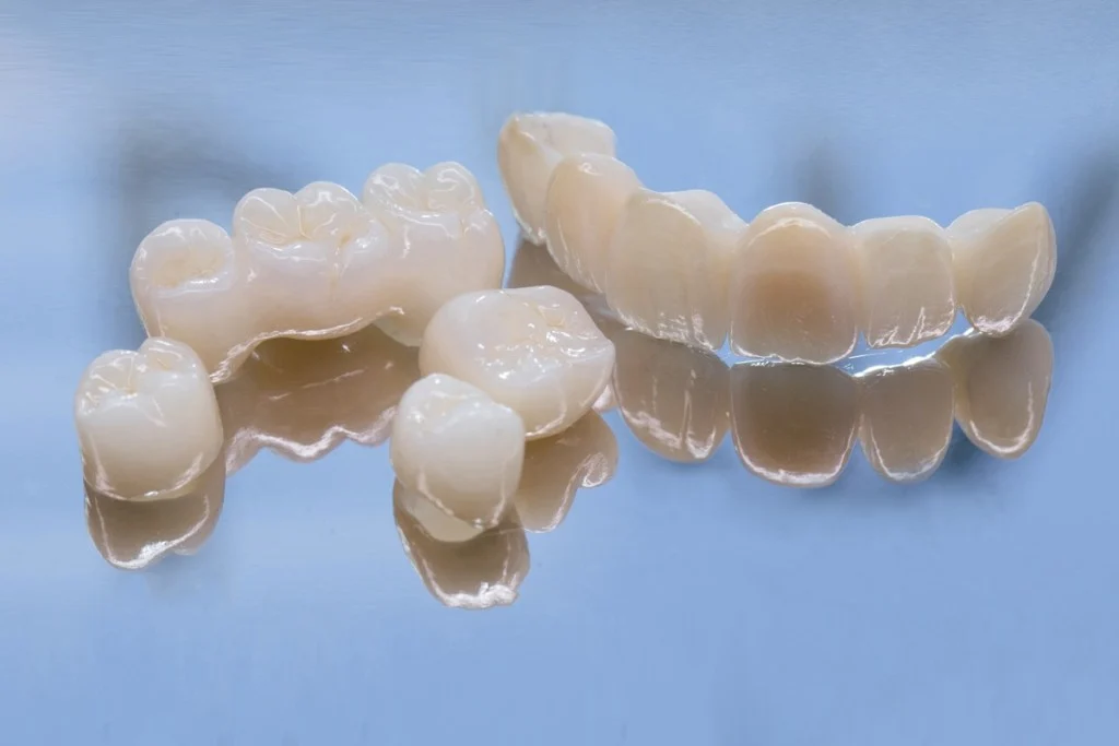 how-different-materials-affect-your-dental-restoration_68a89b9a7fa39