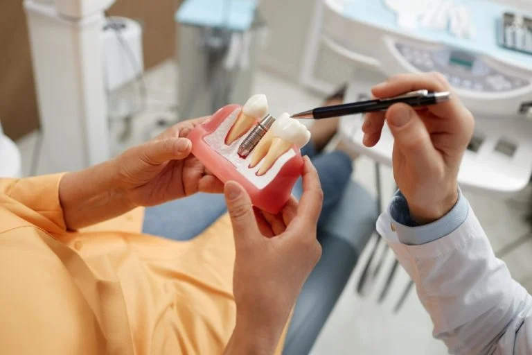 how-to-care-for-your-dental-implants-for-long-term-success_68a89b9144971