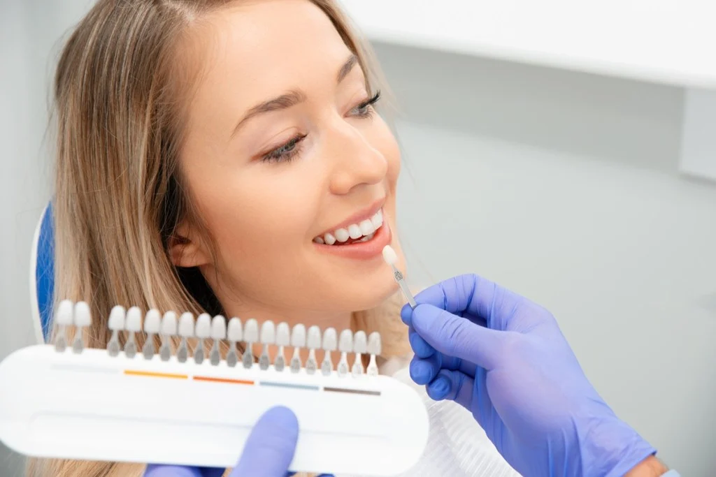 how-well-does-professional-teeth-whitening-actually-work_68a8958ba3f03