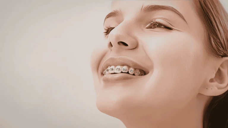 teeth shifting after braces