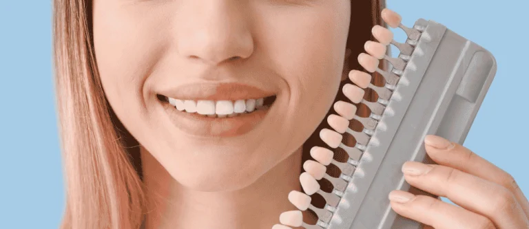 veneers vs bonding for chipped tooth